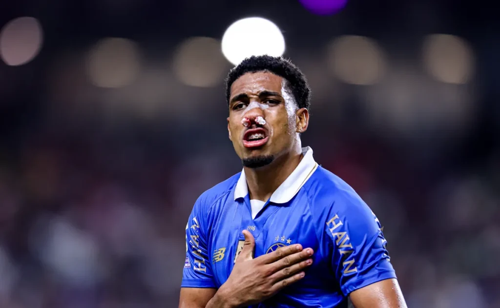 wallace-pede-para-jogar-no-sacrificio-no-gre-nal-455-antes-de-passar-por-cirurgia-no-nariz